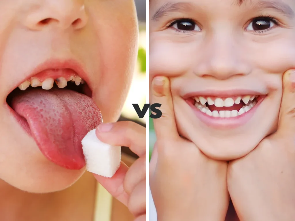 dental sugar damage